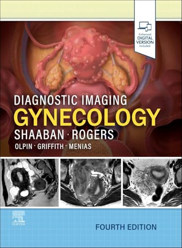 Diagnostic Imaging: Gynecology, 4th edition (Original PDF from Publisher) Diagnostic Imaging: Gynecology, 4th edition (Original PDF from Publisher)