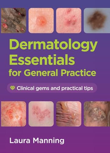 Dermatology Essentials for General Practice (EPUB) Dermatology Essentials for General Practice (EPUB)