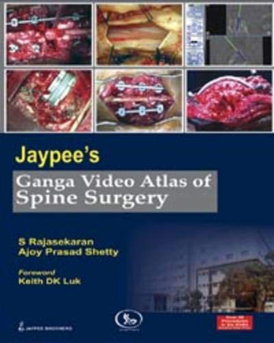 Jaypee’s Ganga Video Atlas of Spine Surgery (Videos Only) Jaypee’s Ganga Video Atlas of Spine Surgery (Videos Only)