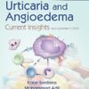Urticaria and Angioedema Current Insights and Updates in 2025, 2nd edition (Original PDF from Publisher)