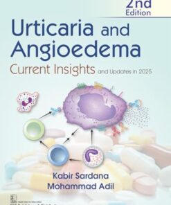 Urticaria and Angioedema Current Insights and Updates in 2025, 2nd edition (PDF)