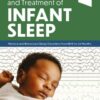 Assessment and Treatment of Infant Sleep: Medical and Behavioral Sleep Disorders from Birth to 24 Months (PDF)