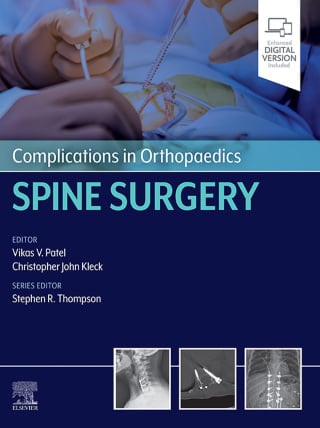 Complications in Orthopaedics: Spine Surgery (PDF) Complications in Orthopaedics: Spine Surgery (PDF)