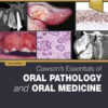 Cawson’s Essentials of Oral Pathology and Oral Medicine, 10th Edition (PDF)