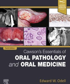 Cawson’s Essentials of Oral Pathology and Oral Medicine, 10th Edition (PDF)