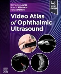 Video Atlas of Ophthalmic Ultrasound (PDF)