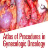 Atlas of Procedures in Gynecologic Oncology, 4th Edition (EPUB)