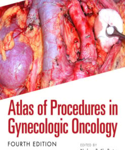 Atlas of Procedures in Gynecologic Oncology, 4th Edition (EPUB)