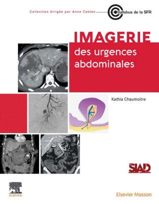 Imagerie des urgences abdominales (PDF) Imagerie des urgences abdominales (PDF)