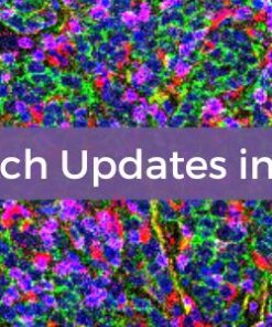 Cedars Sinai Research Updates in Lymphoma 2025