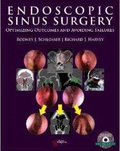 Endoscopic Sinus Surgery: Optimizing Outcomes and Avoiding Failures (EPUB + Videos)