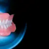 OHI-S Minimal inversiv – not only veneers & Complete dentures as a basis for all on four OHI-S Minimal inversiv – not only veneers & Complete dentures as a basis for all on four