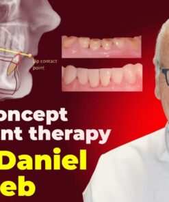 OHI-S OCTA concept and splint therapy