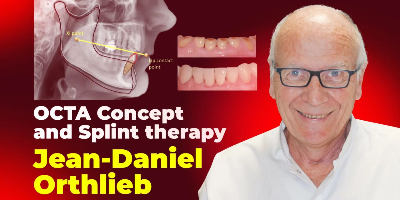 OHI-S OCTA concept and splint therapy OHI-S OCTA concept and splint therapy