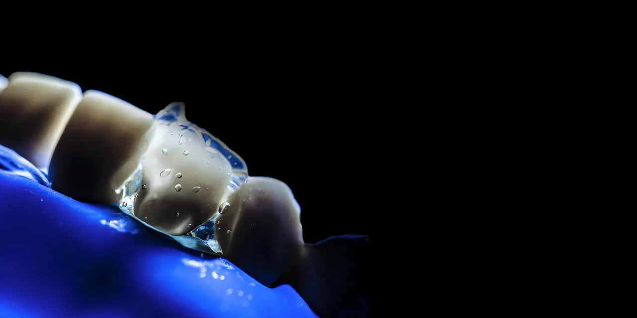 OHI-S Occlusion-driven stress-reduced direct composite (SRDC) OHI-S Occlusion-driven stress-reduced direct composite (SRDC)