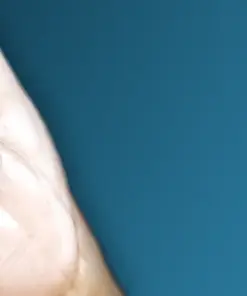 OHI-S Root perforations – diagnosis and treatment