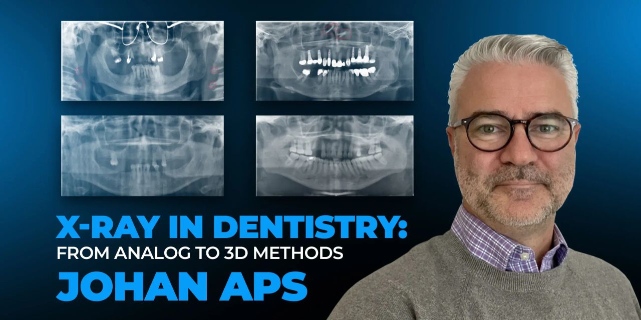 OHI-S X-ray in dentistry from analog to 3D methods