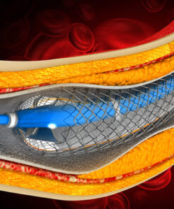 Oakstone Comprehensive Review and Update of What’s New in Vascular and Endovascular Surgery 2025