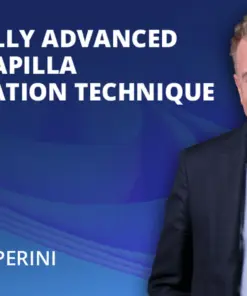 Osteocom Coronally Advanced Entire Papilla Preservation Technique