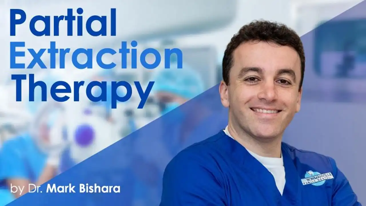 Osteocom Partial Extraction Therapy