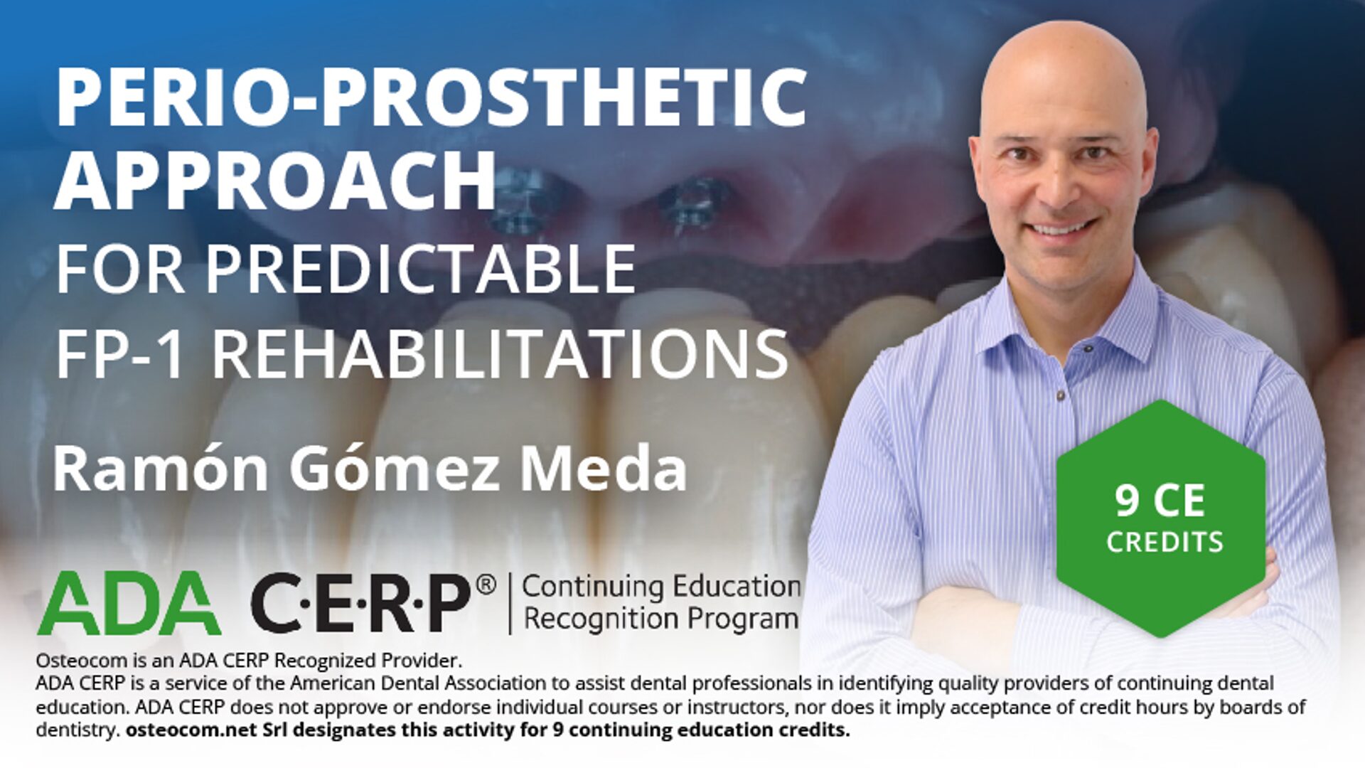 Osteocom Perio-Prosthetic Approach for FP-1 Rehabilitations