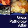 Gross Pathology Atlas: A Guide to Gross Specimens Evaluation (PDF)