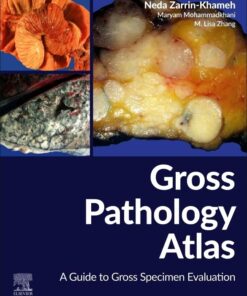 Gross Pathology Atlas: A Guide to Gross Specimens Evaluation (PDF)