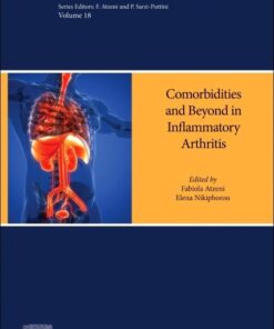 Inflammatory Arthritis Beyond the Joints: Comorbidities and other Manifestations (Handbook of Systemic Autoimmune Diseases, Volume 18) (True PDF)