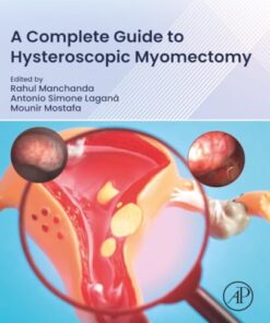 A Complete Guide to Hysteroscopic Myomectomy (PDF)