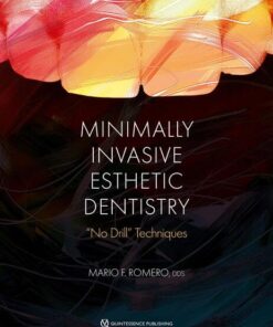 Minimally Invasive Esthetic Dentistry: “No Drill” Techniques (PDF)