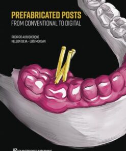 Prefabricated Posts: From Conventional to Digital (EPUB)