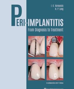 Peri-Implantitis: From Diagnosis to Treatment (EPUB)