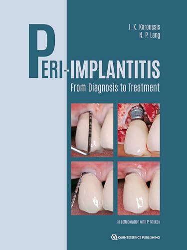 Peri-Implantitis: From Diagnosis to Treatment (EPUB)