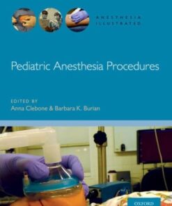 Pediatric Anesthesia Procedures (EPUB)