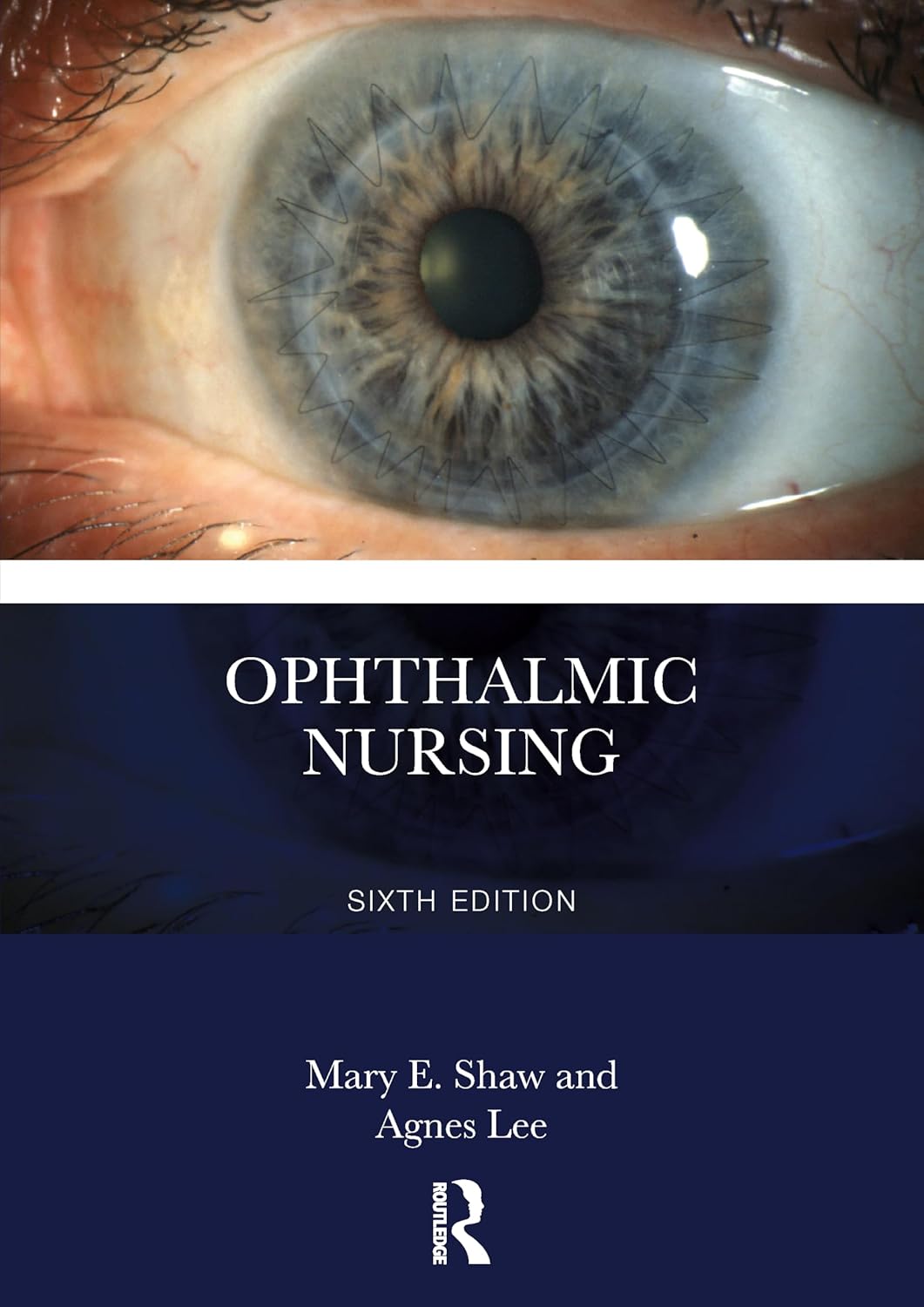 Ophthalmic Nursing, 6th Edition (EPUB) Ophthalmic Nursing, 6th Edition (EPUB)