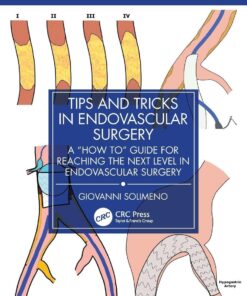 Tips and Tricks in Endovascular Surgery: A “How to” Guide for reaching the next Level in Endovascular Surgery (EPUB)
