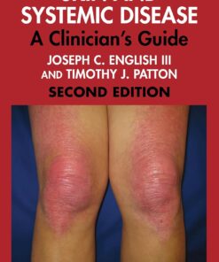 Skin and Systemic Disease: A Clinician’s Guide, 2nd Edition (PDF)