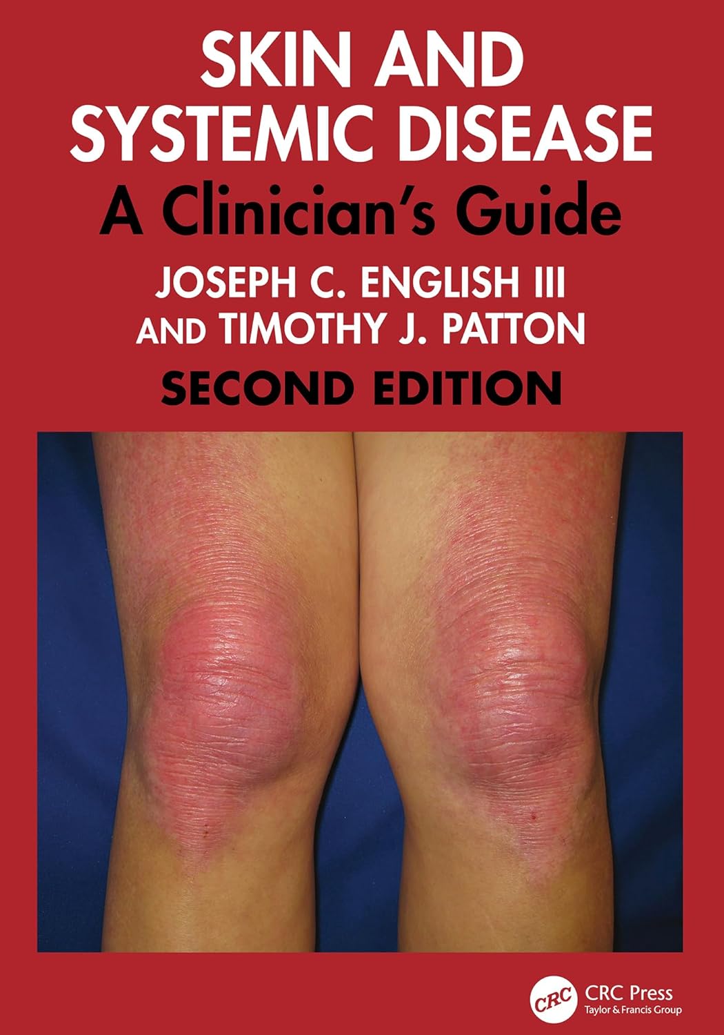 Skin and Systemic Disease: A Clinician’s Guide, 2nd Edition (PDF) Skin and Systemic Disease: A Clinician’s Guide, 2nd Edition (PDF)