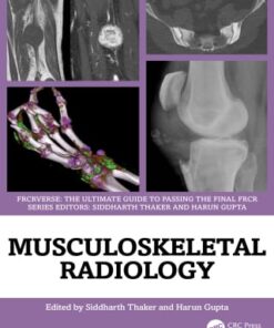 Musculoskeletal Radiology (EPUB)