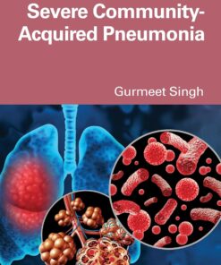 Severe Community-Acquired Pneumonia (EPUB)