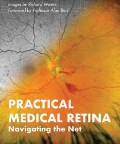 Practical Medical Retina (EPUB)