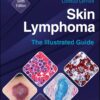 Skin Lymphoma: The Illustrated Guide, 6th Edition (EPUB)