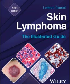 Skin Lymphoma: The Illustrated Guide, 6th Edition (EPUB)