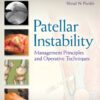 Patellar Instability (EPUB)
