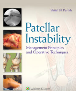 Patellar Instability (EPUB)
