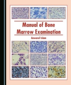 Manual of Bone Marrow Examination (PDF)
