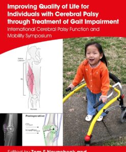 Improving Quality of Life for Individuals with Cerebral Palsy through treatment of Gait Impairment: International Cerebral Palsy Function and Mobility Symposium (Clinics in Developmental Medicine) (EPUB)