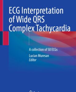 ECG Interpretation of Wide QRS Complex Tachycardia: A collection of 50 ECGs (EPUB)