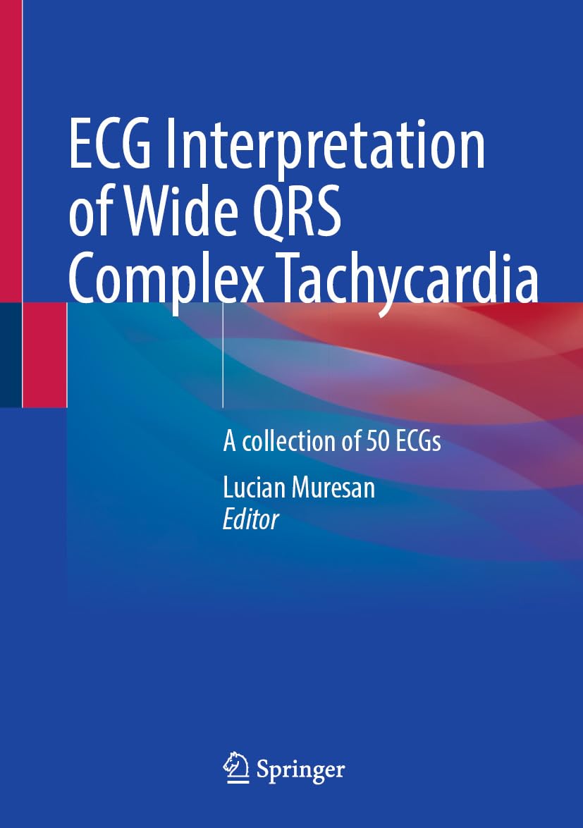 ECG Interpretation of Wide QRS Complex Tachycardia: A collection of 50 ECGs (PDF) ECG Interpretation of Wide QRS Complex Tachycardia: A collection of 50 ECGs (PDF)