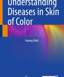Understanding Diseases in Skin of Color (EPUB)